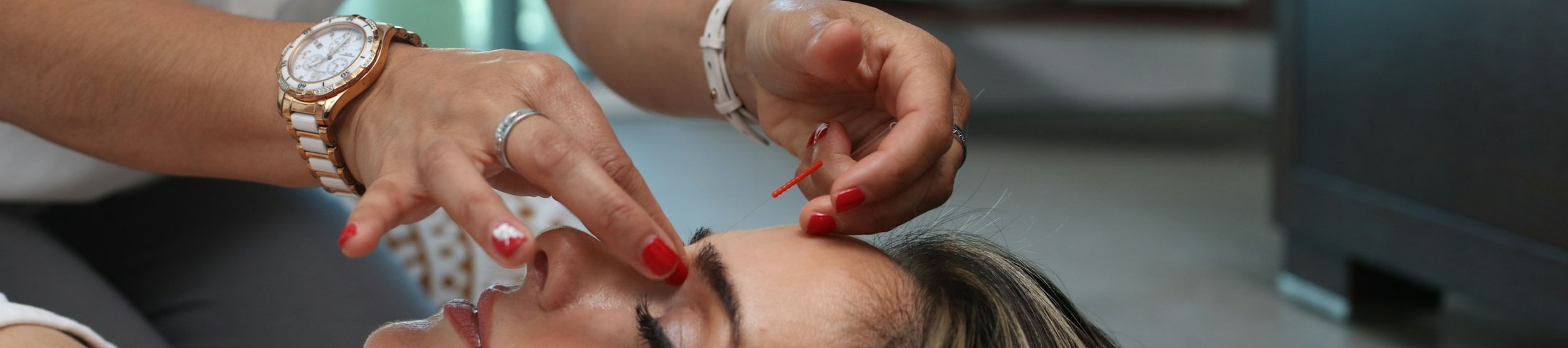 Provider performing an exosome hair restoration treatment on a patient