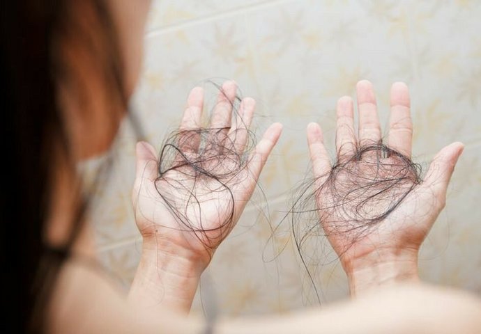 Woman holding hair lost to thinning and shedding